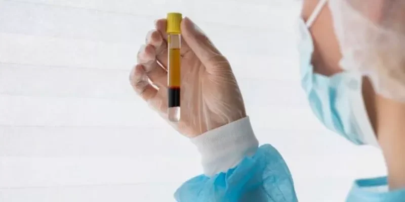 SVF Kök Hücre Tedavisi